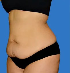 Cirugia-estetica-antes-y-despues Cirugia-estetica-antes-y-despues